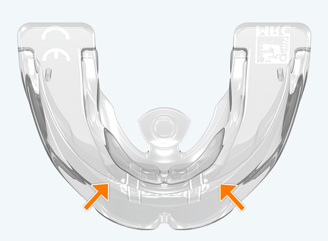 Tooth channels