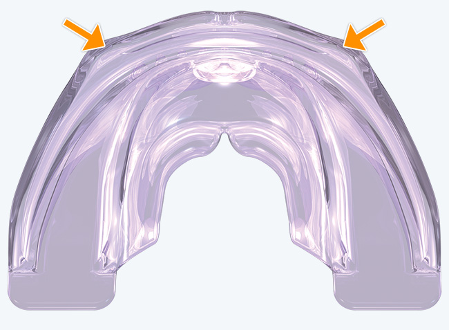 Robust anterior arch form