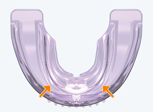 Tooth channels