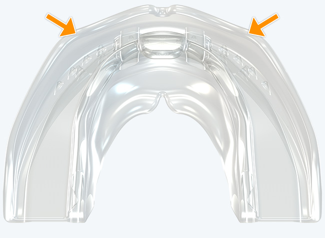 Forma de arco anterior robusta
